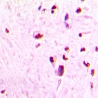 Polyclonal Rabbit anti-Human SAP18 Antibody (IHC, WB)