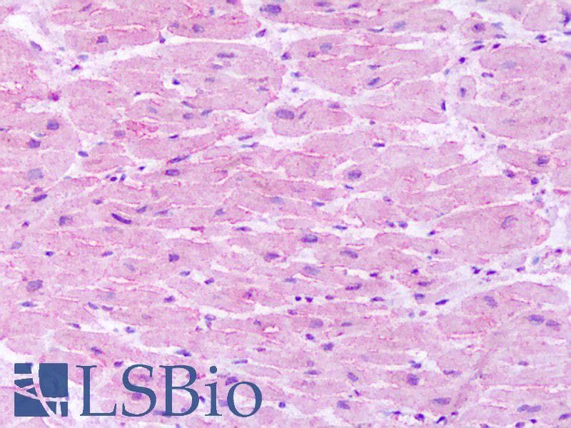 IHC-plus™ TACR1 / NK1R Antibody (C-Terminus)