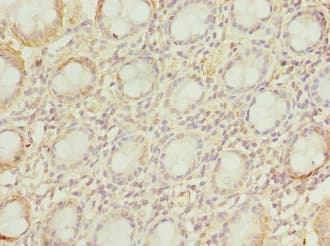 Polyclonal Rabbit anti-Human VILIP / VSNL1 Antibody (IHC)