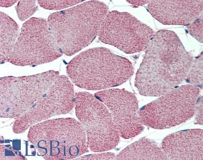 IHC-plus™ Polyclonal Rabbit anti-Human CACNG1 / CACNG Antibody (IHC, WB)