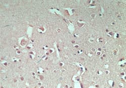RNF128 / GRAIL Antibody (aa227-253)
