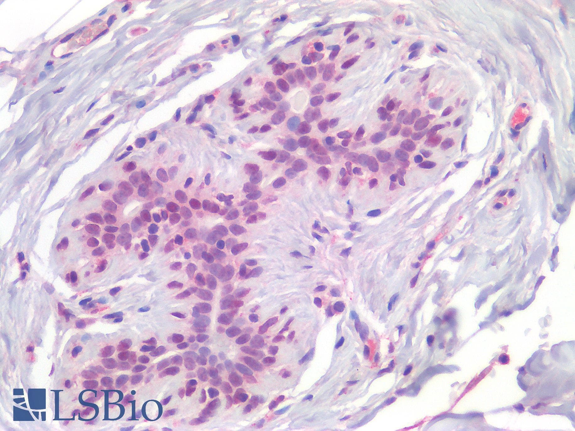 IHC-plus™ AML1 / RUNX1 Antibody