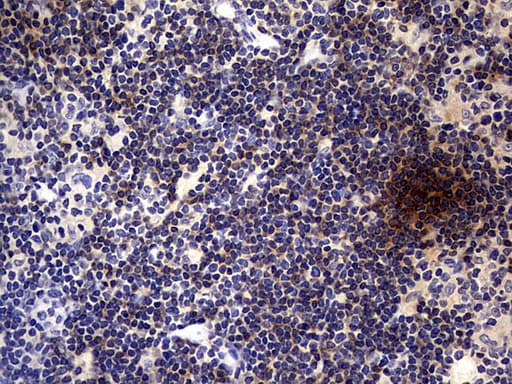 CD30 Antibody (aa19-379, clone OTI3A2)