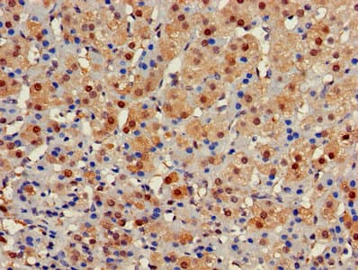 GALT Antibody