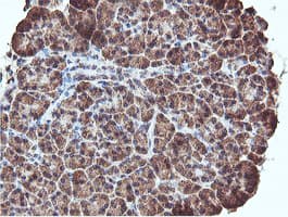 REEP2 Antibody (clone OTI2C7)