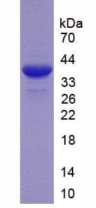 Human LTBP2 Protein (Recombinant His, N-Terminal)