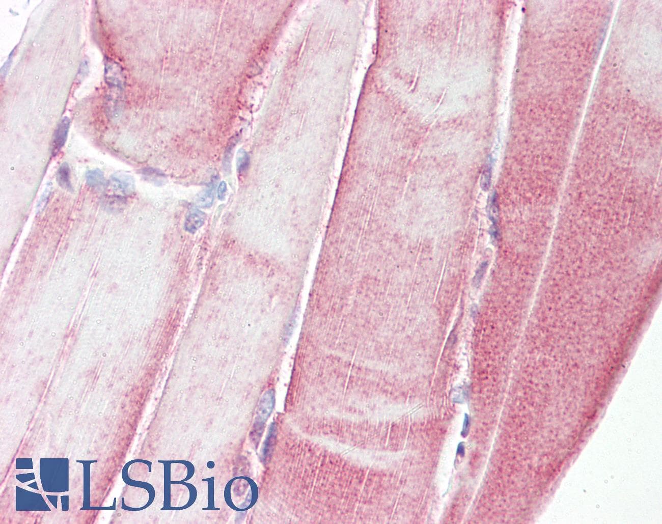 IHC-plus™ HSPB1 / HSP27 Antibody (aa45-94)