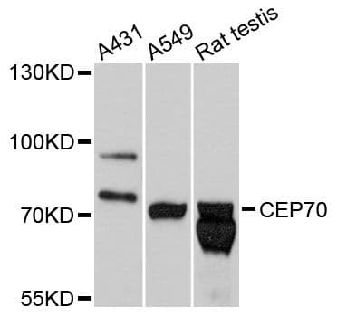 Polyclonal Rabbit anti-Human CEP70 Antibody (WB)