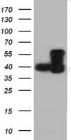 DYNC1LI1 Antibody (clone OTI1C2)