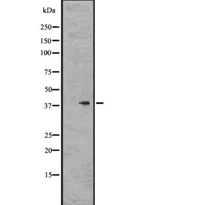 Polyclonal Rabbit anti-Human GPR78 Antibody (IHC, WB)