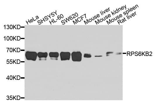 RPS6KB2 / S6K2 Antibody