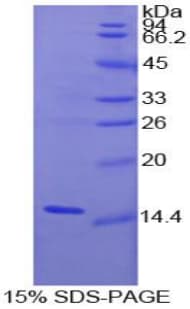 Human IL15 Protein (Recombinant His)
