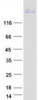 Human DCC Protein (Recombinant Myc-DDK (Flag))