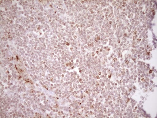 TFPI / LACI Antibody (aa29-304, clone OTI5H5)