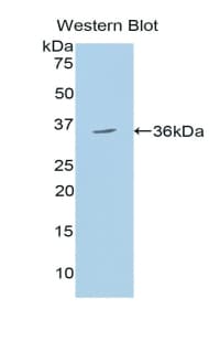HYOU1 / ORP150 Antibody (aa695-994)