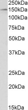 PathPlus™ Polyclonal Goat anti-Human HDAC6 Antibody (aa1100-C-term, IHC, WB)