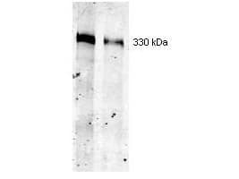 IHC-plus™ TG / Thyroglobulin Antibody (clone 2H11)