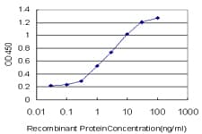 IHC-plus™ Monoclonal Mouse anti-Human SMAD3 Antibody (clone 2C12, IHC, WB)
