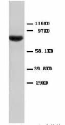Polyclonal Rabbit anti-Human STAT1 Antibody (Sepharose, C-Terminus)