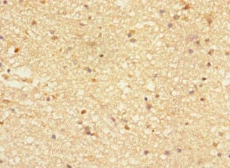 NTM / Neurotrimin Antibody