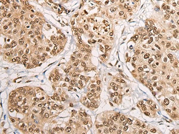 PHF21A / BHC80 Antibody