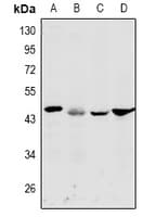 DFFA / ICAD / DFF45 Antibody