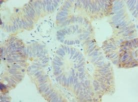 Polyclonal Rabbit anti-Human CSRNP1 / AXUD1 Antibody (aa1-200, IHC)