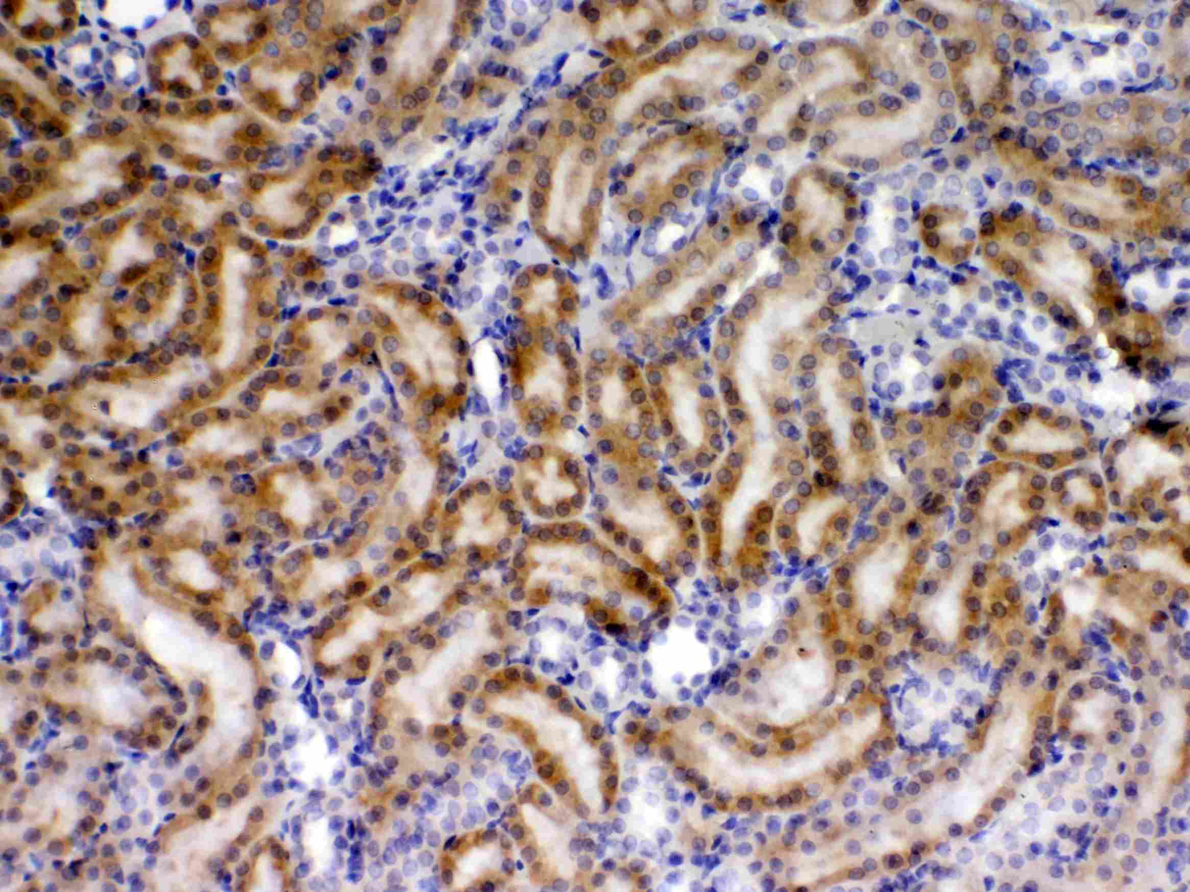 Polyclonal Rabbit anti-Human TIMP4 Antibody (IHC, WB)