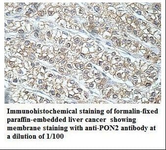 PON2 Antibody (aa42-177)