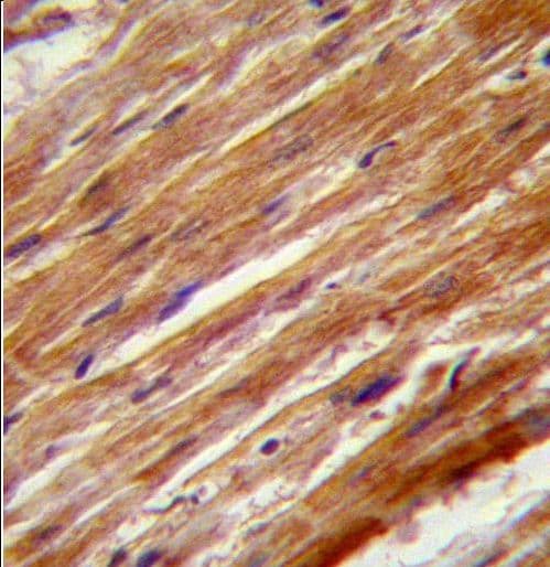 MAP3K4 / MEKK4 Antibody (aa1067-1097)