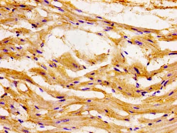 Polyclonal Rabbit anti-Human CCL15 / MIP5 Antibody (IHC)