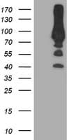 PFKP Antibody (clone OTI3G8, Carrier-free)