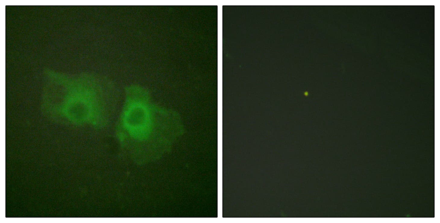 KRT18 / CK18 / Cytokeratin 18 Antibody (aa1-50)