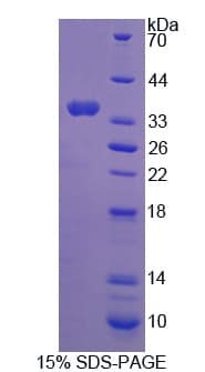 Human ROS1 / ROS Protein (Recombinant His)