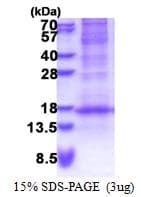 Human DEFB116 Protein (Recombinant His)