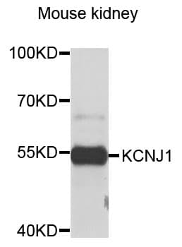 IHC-plus™ Polyclonal Rabbit anti-Human KCNJ1 / ROMK Antibody (IHC, WB)