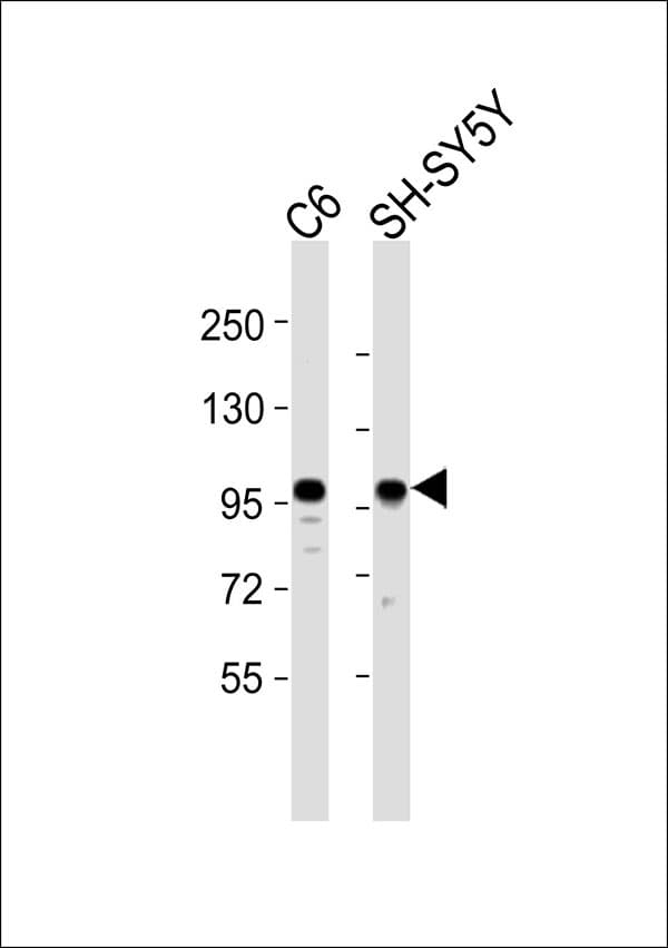 Polyclonal Rabbit anti-Human GIT1 Antibody (WB)
