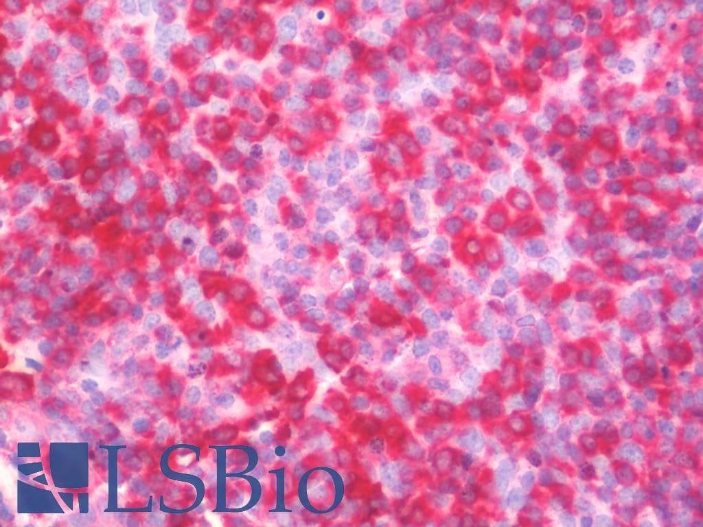 IHC-plus™ VASP Antibody (clone 4D6)
