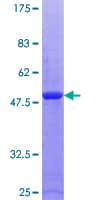 Human RAB9A / RAB9 Protein (Recombinant GST)
