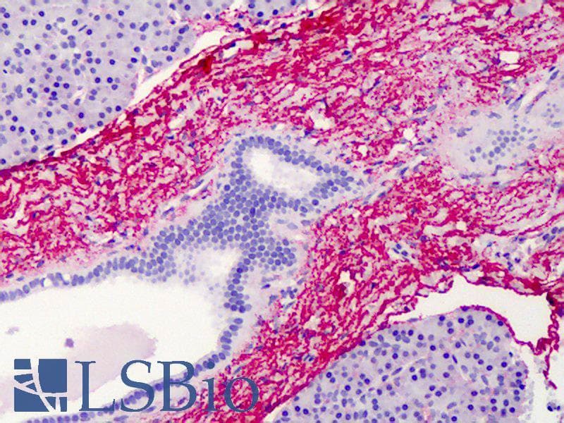 IHC-plus™ Polyclonal Rabbit anti-Human ELN / Elastin Antibody (IHC, IF)