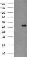 TBC1D21 Antibody (clone OTI3F1)