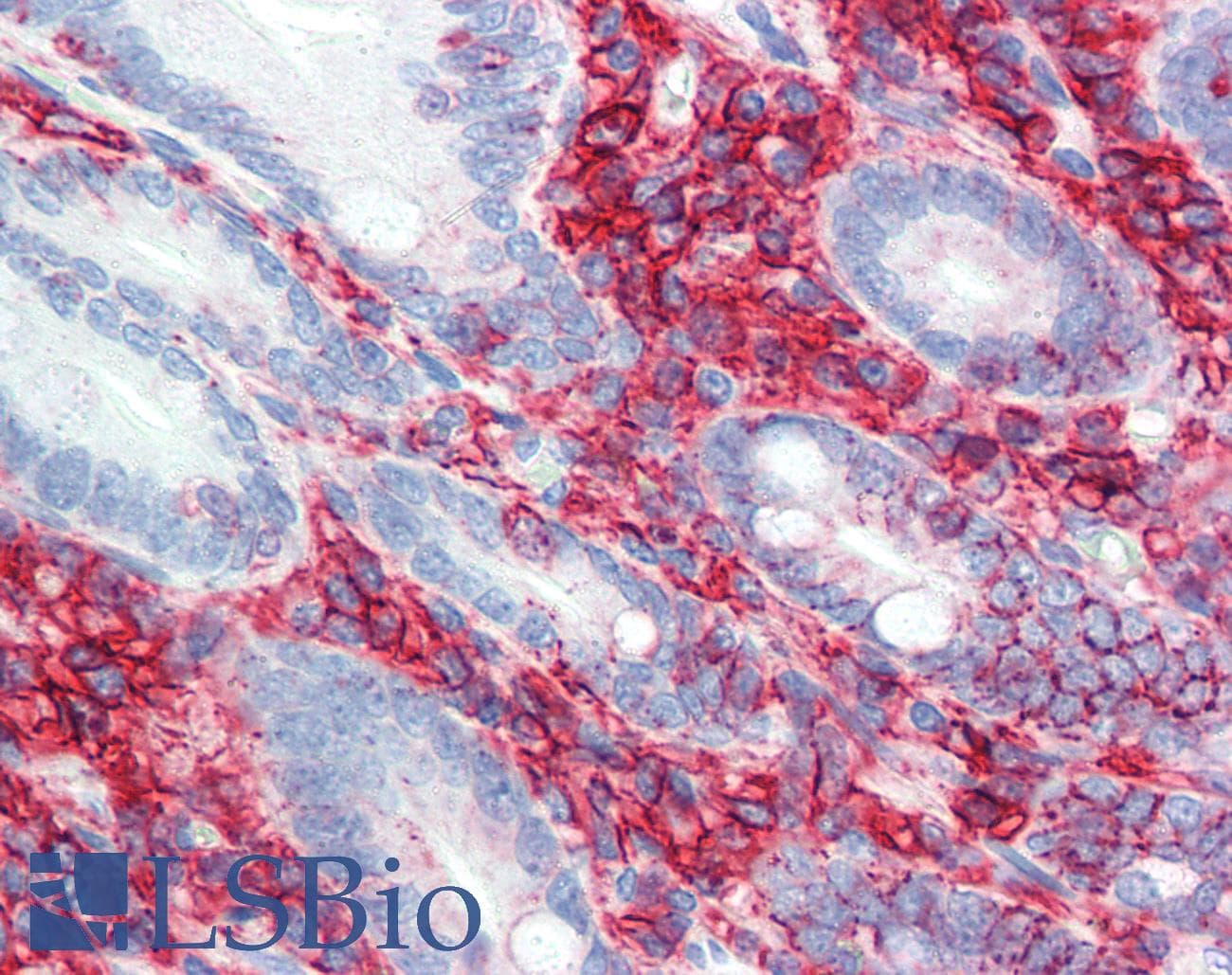 PathPlus™ CD44 Antibody (clone MEM-85)