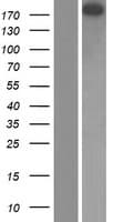 TP1 / TEP1 Protein (Over-Expression Lysate Myc-DDK (Flag))