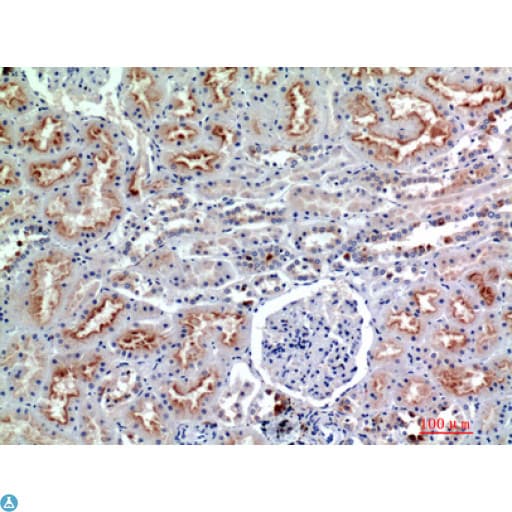 NCAM / CD56 Antibody