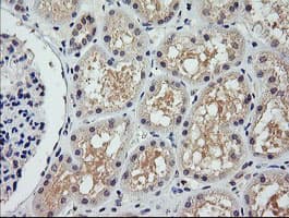 Monoclonal Mouse anti-Human COG6 Antibody (clone OTI1B8, IHC, IF, WB)