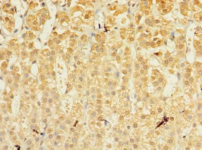 Polyclonal Rabbit anti-Human MRPL53 Antibody (IHC)
