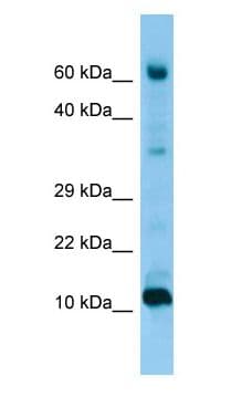 FABP9 / Lipid-Binding Protein Antibody (aa64-113)
