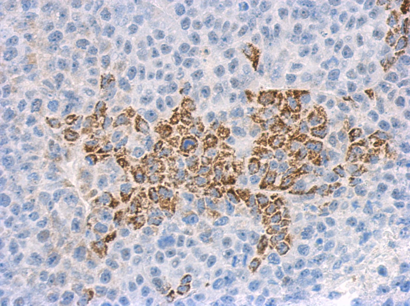 IL1F9 Antibody (aa105-169)