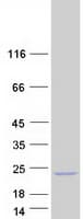Human PSORS1C1 Protein (Recombinant Myc-DDK (Flag))
