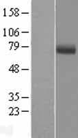 EYS Protein (Over-Expression Lysate Myc-DDK (Flag))
